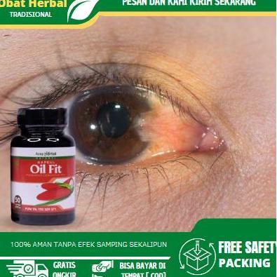 Solusi Untuk Mengatasi Mata Berlemak, Pterigium, Pembersih Pterigium, Penghilang Lamad Pada Selaput 