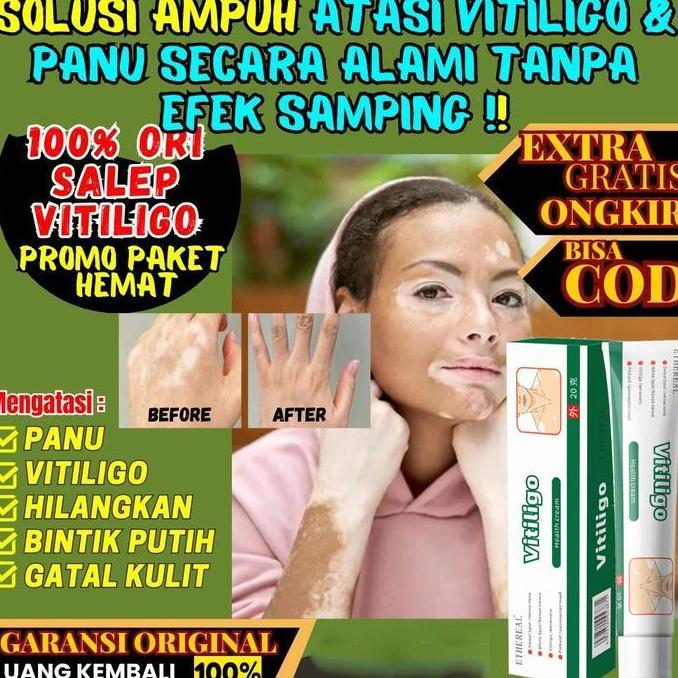 Tiange Salep Herbal Vitiligo Ampuh Atasi Masalah Kulit Panuan Original 20Gr |Obat Salep Herbal China