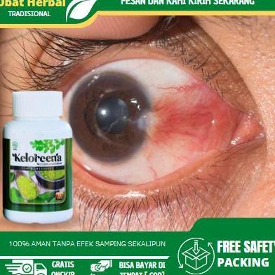 Solusi Untuk Mengatasi Mata Berlemak, Ptregium, Penghilang Lamad Di Mata, Vitamin Untuk Mata, Mata M