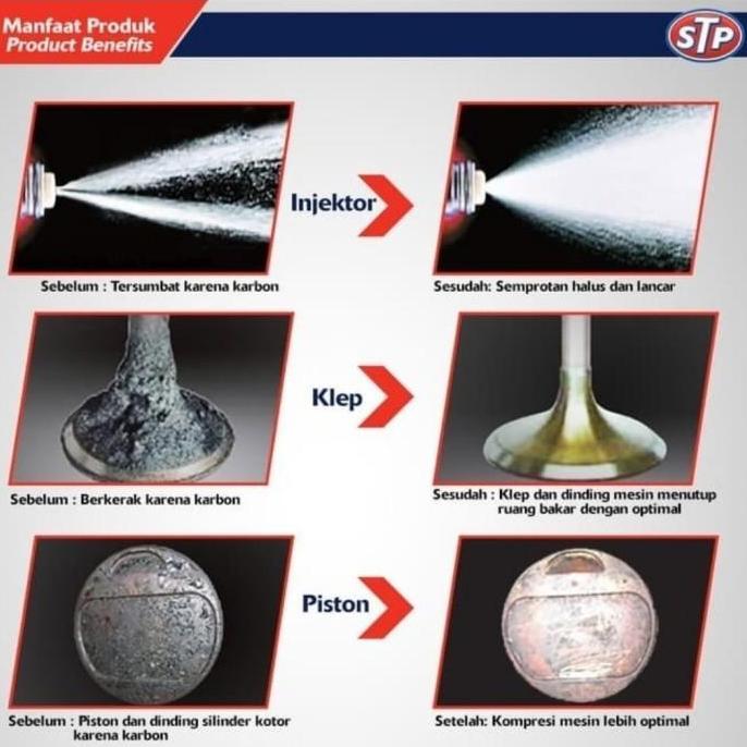 STP complete fuel system cleaner 400ml STP ori pembersih karbulator