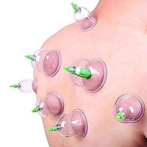 Medclean- Alat Bekam 12 Cup Kop Sammora Samora Cop Angin Badan Vacuum Cupping Cup Kit Therapi