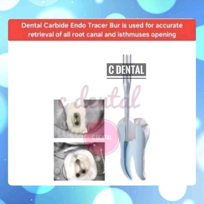 DENTAL ENDO ORIFICE TRACER BUR CARBIDE XTRA LONG SHANK OPENING ACCESS FINDING HIDDEN CANAL