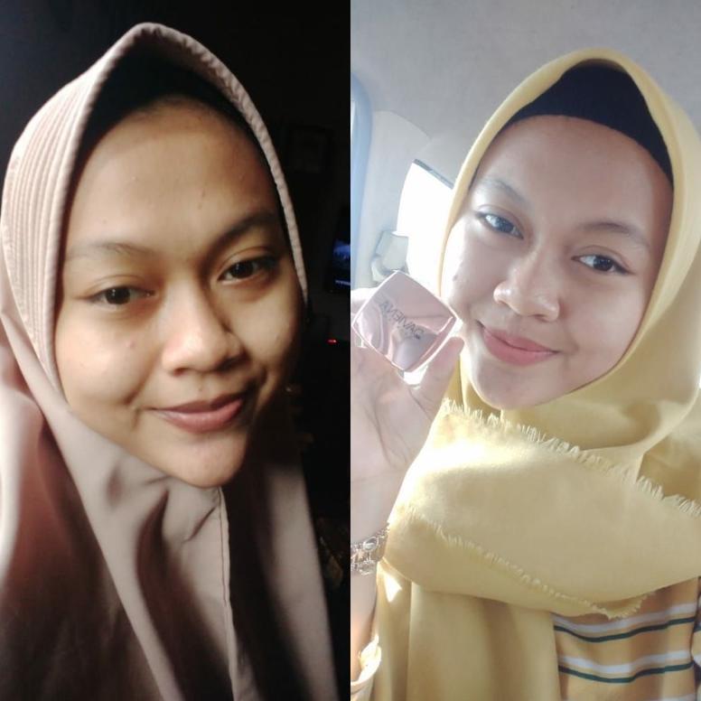 Unique - [Official] Daviena Skincare | Glowing Series | Pemutih Wajah Bpom|Davina Skincare Original