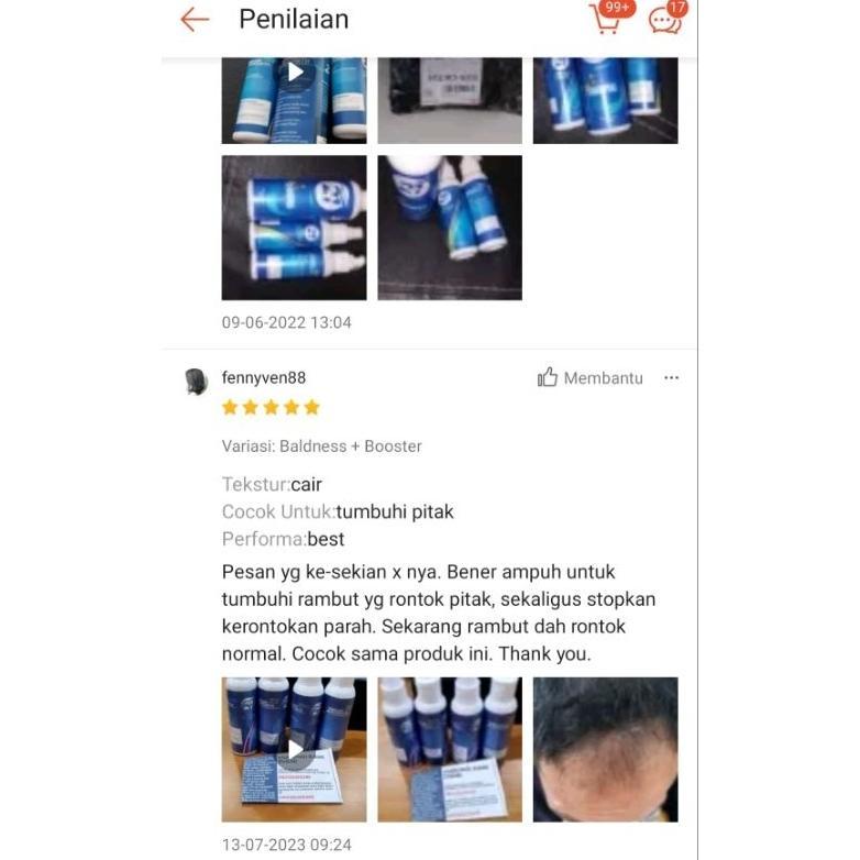 21 Hair Growth - Paket Baldnes - Penumbuh Rambut