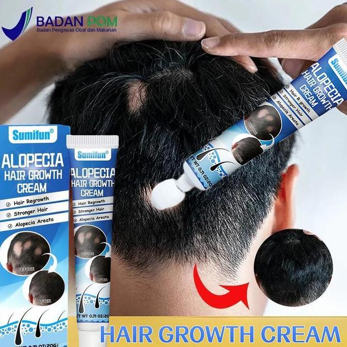 Letssist- [Ramadhan Sale] Obat Alopecia Areata, Penumbuh Rambut Cepat Obat, Penumbuh Rambut Botak Pr