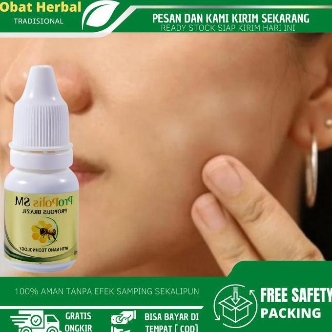 LAZZBUINA - CAIRAN OLES  PERAWATAN  PANU DI WAJAH, BERCAK PUTIH DI WAJAH, PENGHILANG PANU, KULIT WAJ