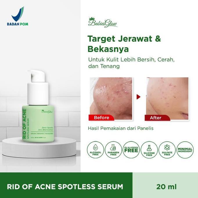 Babies Glow - Rid of Acne Spotless Serum