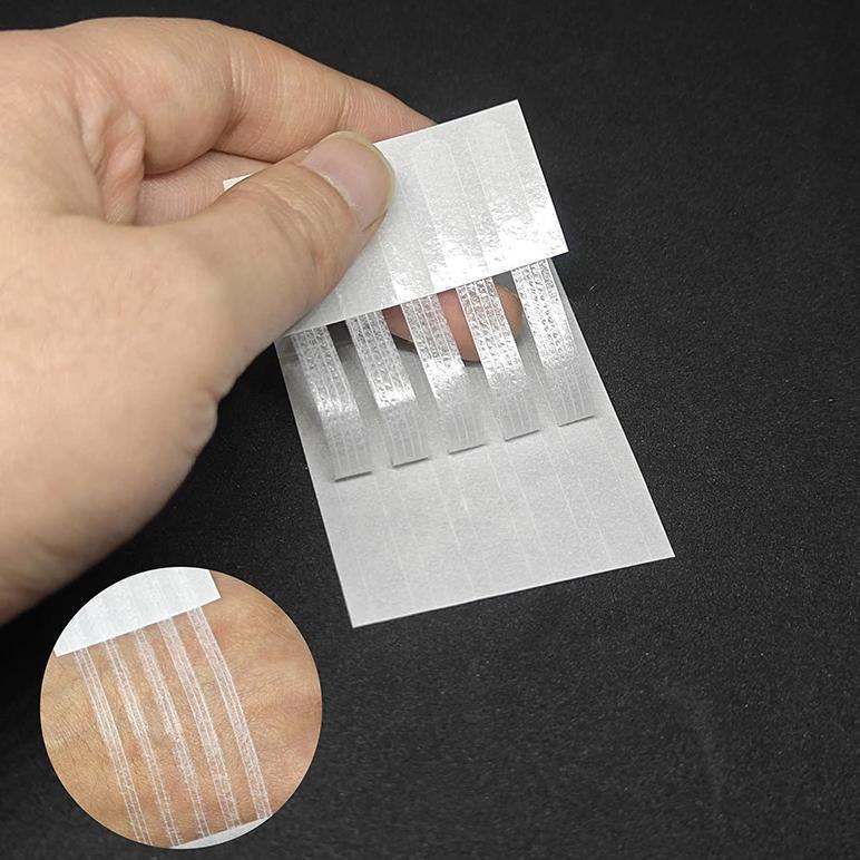 1PC Sterile Strip Scar Away Acne Scar Marks Remover Sterile First Aid Travel Wound Skin Closures Med