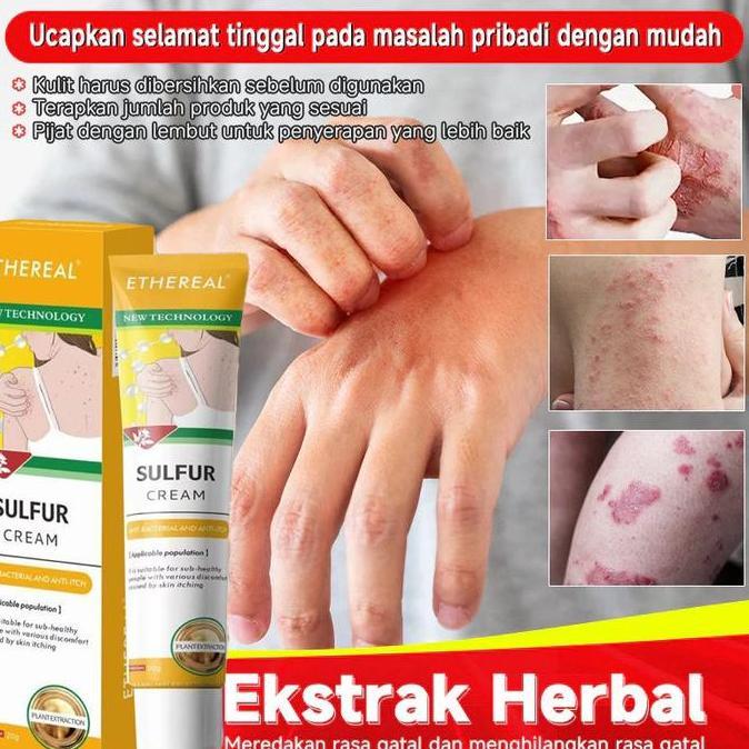 Salep Eksim Anak Salep Obat Salep Salep Eksim Anak Krim Popok Untuk Meredakan Gatal Anti Gatal Kerin
