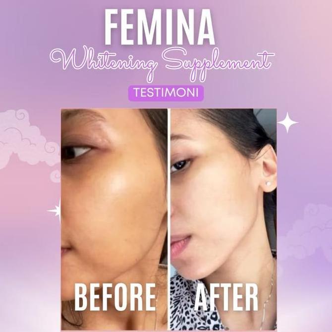 Absolute- Paket 3 Botol + 1 Botol Femina Suplemen Pemutih Badan Dan Kulit Aman Original Bpom