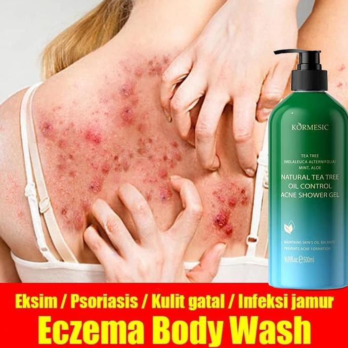 BERKUALITAS Eczema body wash gatal kulit gel shower Pengobatan Eksim Psoriasis Kurap Gatal kulit Jam