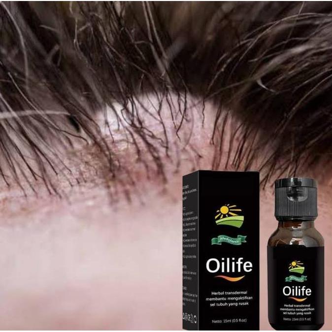 Vitbig- Oilife - Minyak Oles Benjolan Di Kepala Original Bpom