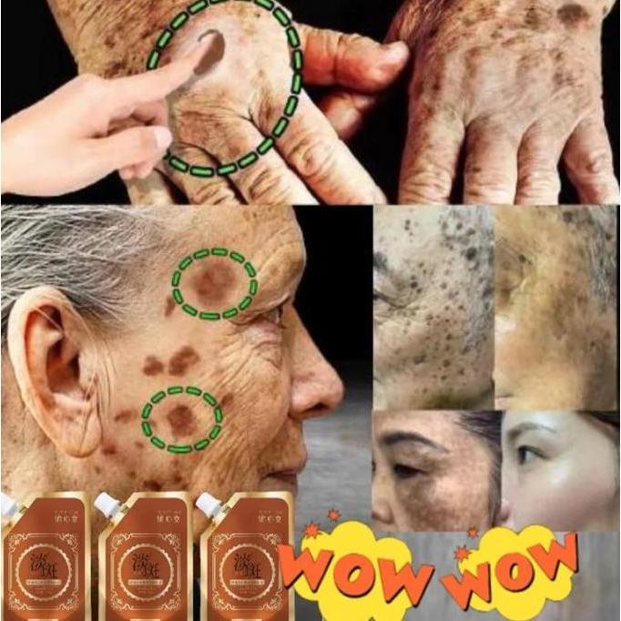 Bytcwr- Masker Wajah Menghilangkan Bintik-Bintik Topeng Koyak Anti Penuaan & Anti Kedut Kolagen 100%