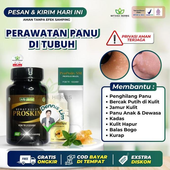 Feminin- Proskin Penghilang Panu Perawatan Kulit Bercak Putih Jamur Kulit Kadas Kudis Kurap Panu Ana