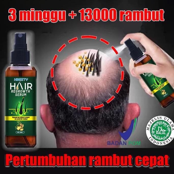 Haircare- Hair Growth Spray Penumbuh Rambut Cairan Serum Penumbuh Rambut Anti Rontok / Obat Rambut B
