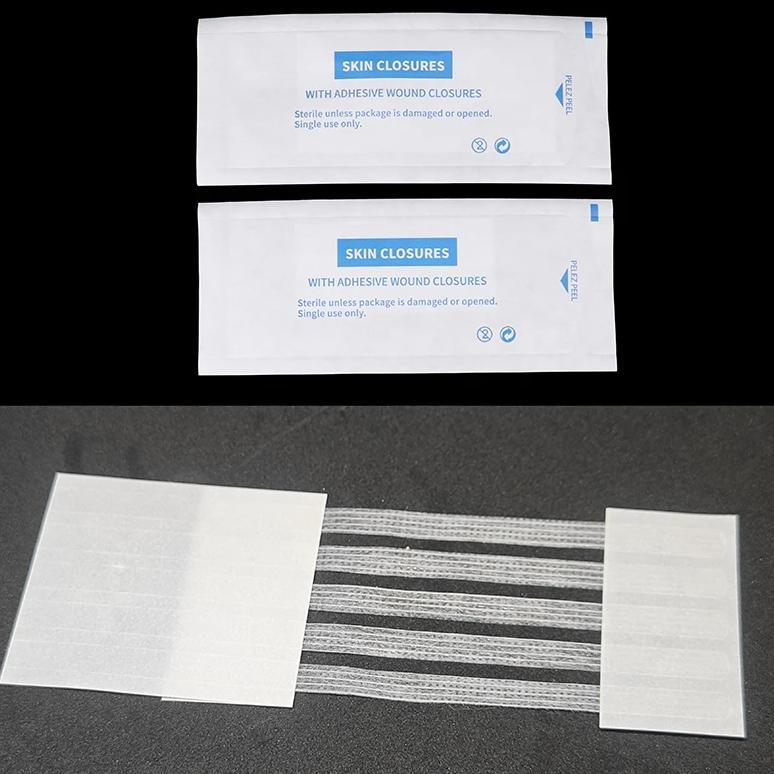 Sterile Strip Scar Away Acne Scar Marks Remover Sterile First Aid Travel Wound Skin Closures Medical