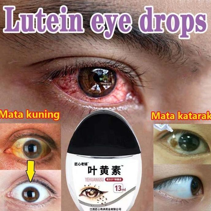 Obat Mata Minus Obat Mata Katarak Obat Tetes Mata Pembersih Mata 13Ml Tetes Mata Kuning Obat Mata Be