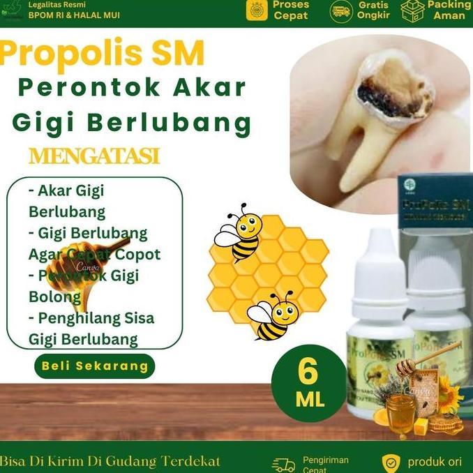 Clearx- Propolis Sm Perontok Akar Gigi Berlubang, Perontok Gigi Bolong, Penghilang Sisa Gigi Berluba