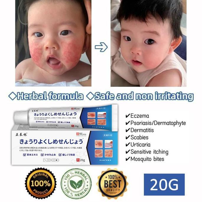 Salep gatal paling ampuh salep jamur kulit gatal selangkangan dan hitam salep eksim salap gatal kuli