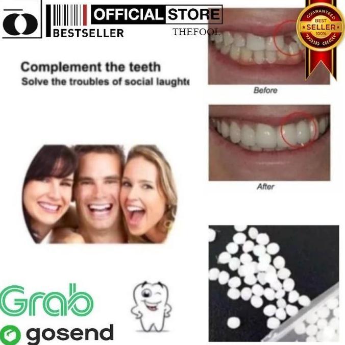 MONTMERY Fident Penambal Gigi TF