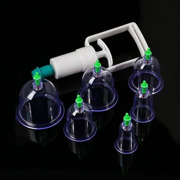 si_baybaystore - set alat bekam kop angin 6 cup untuk seluruh kesehatan canduk  bekam cupping  set a