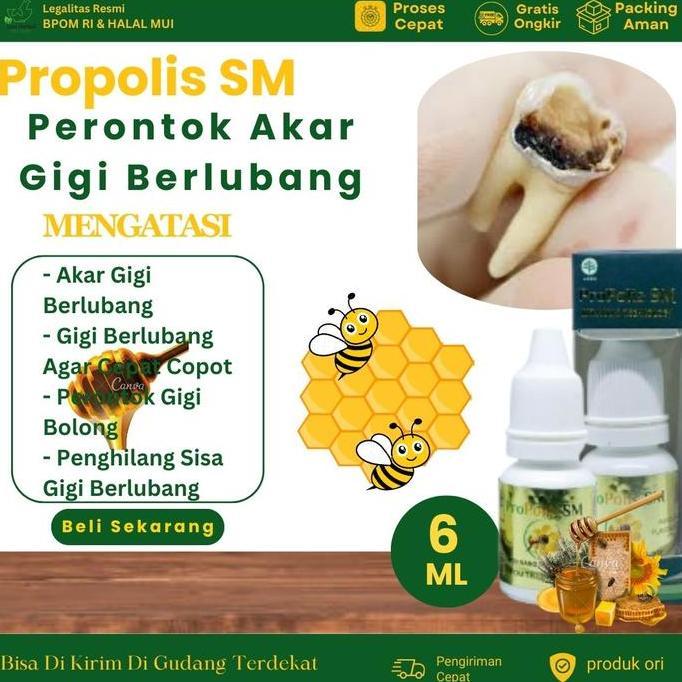 Cantaca900 - Propolis SM Perontok Akar Gigi Berlubang, Perontok Gigi Bolong, Penghilang Sisa Gigi Be