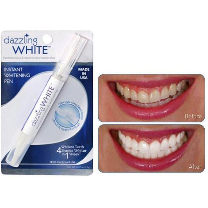 KLUDENG Alat Pemutih Gigi Pena Pemutih Gigi Teeh Whitening Gel Pemutih Gigi
