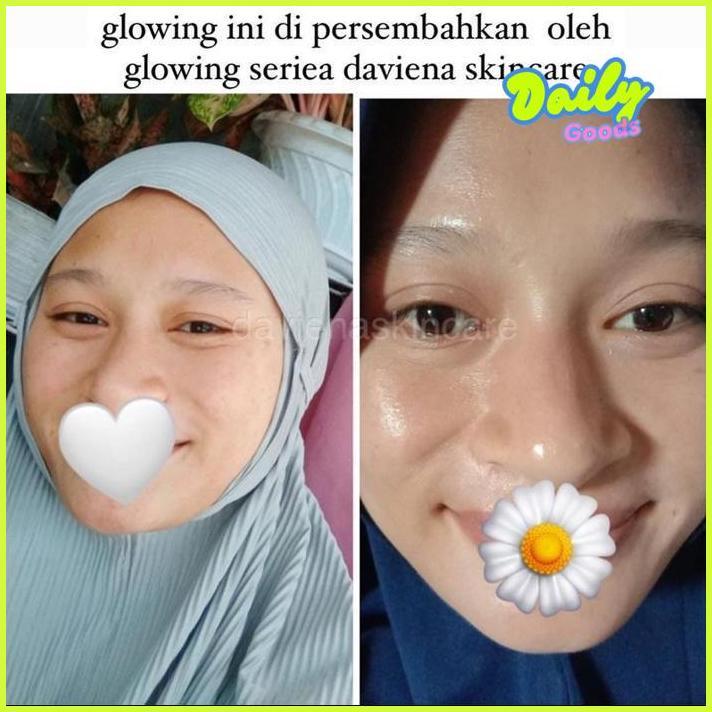 gha-68 [Official] Daviena Skincare | GLOWING SERIES | PEMUTIH WAJAH BPOM|DAVINA SKINCARE Berkualitas