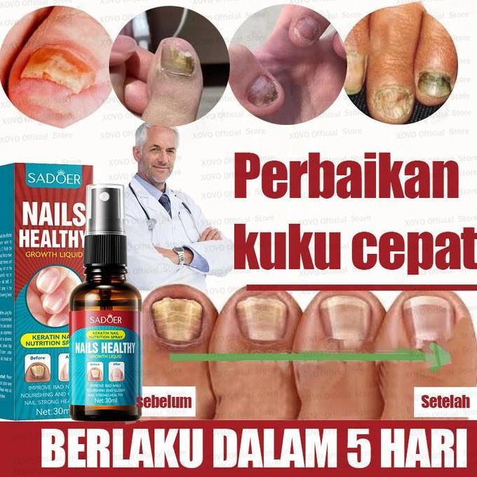 Nail Repair Essence Serum Perawatan Kuku Berjamur Serum Penghilang Jamur Di Kuku  Vitamin Kuku Rusak