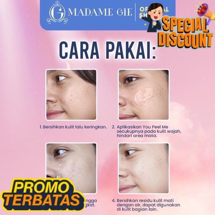 Cuci Gudang Madame Gie You Peel Me Peeling Gel By Madame Gie Exfoliating Gel Exfo Gel Scrub Wajah Ho
