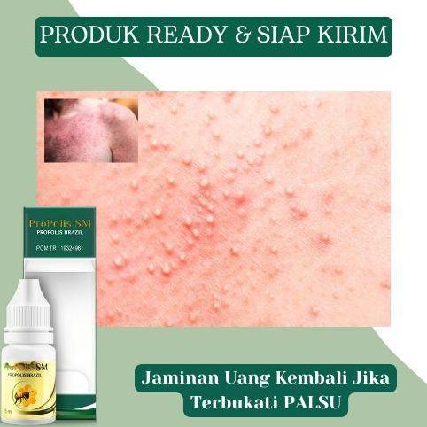 Salep Cairan Oles Untuk Biang Keringat, Bintik Di Kulit, Ruam, Gatal, Kulit Alergi, Iritasi, Penghil