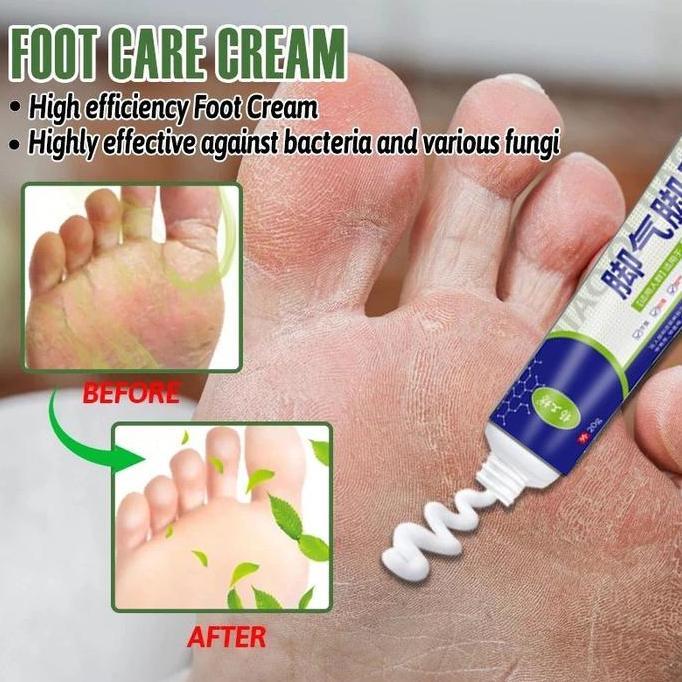 Hayuco- Obat Jamur Kaki Krim Anti Infeksi Dan Gatal Jamur Kaki 20G Obat Jamur Kaki Salep Jamur Kaki 