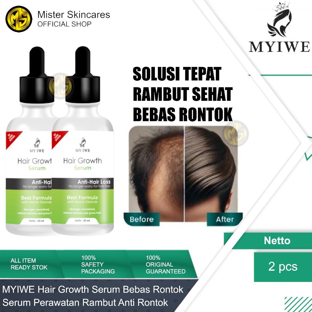 MYIWE Hair Growth Serum Penumbuh Rambut Anti Kebotakan My Iwe Hair Growth Serum Penumbuh Rambut