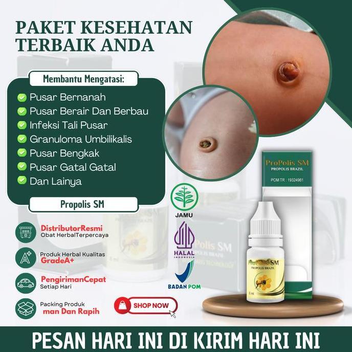 Propolis Sm Solusi Untuk Mengatasi Infeksi Tali Pusar, Pusar Berair Dan Berbau, Pusar Bernanah, Gran