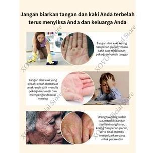 Bytwx- Salep Kaki Pecah Pecah Kering Krim Pelembap Untuk Kaki Kering Dan Pecah-Pecah 60 Gram Perawat