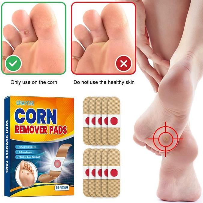 Bytwx- Plester Mata Ikan Plester Obat Kutil Foot Corn Removal Penutup Kutil Obat Mata Ikan Kapalan C