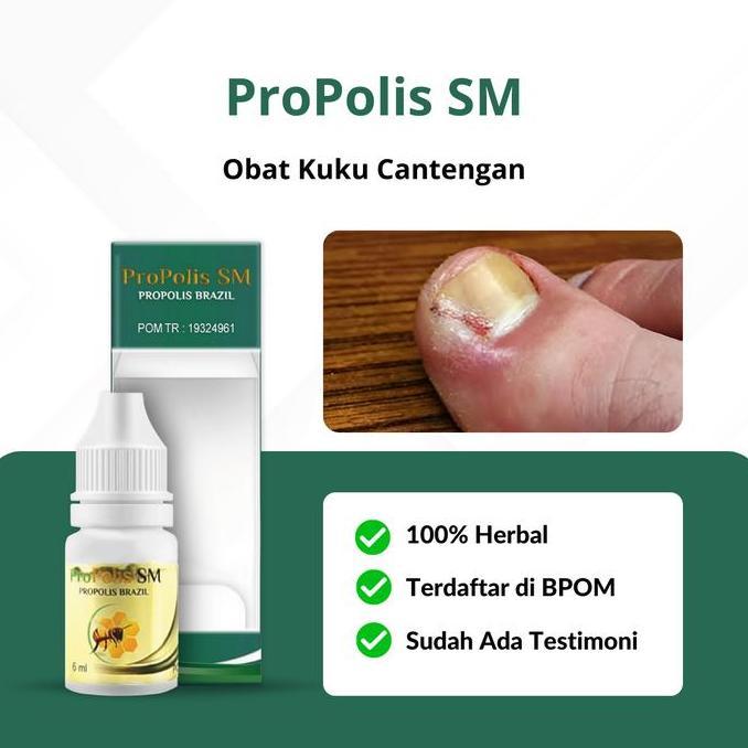 Obat Cantengan Jempol Kaki Bengkak, Obat Jamur Kuku Kaki, Propolis SM