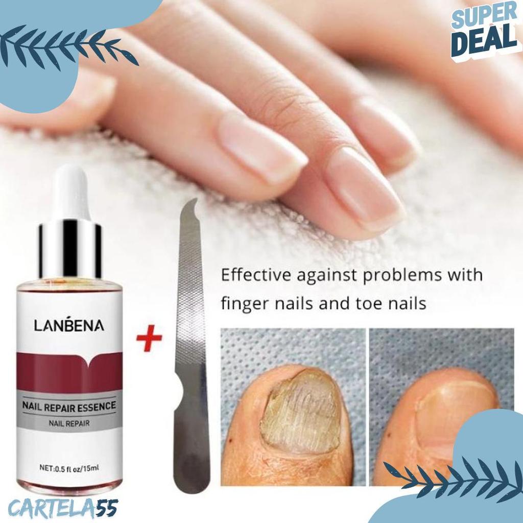 Cod Lanbena Nail Repair Essence Serum Perawatan Jamur Kuku Lanbena Nail