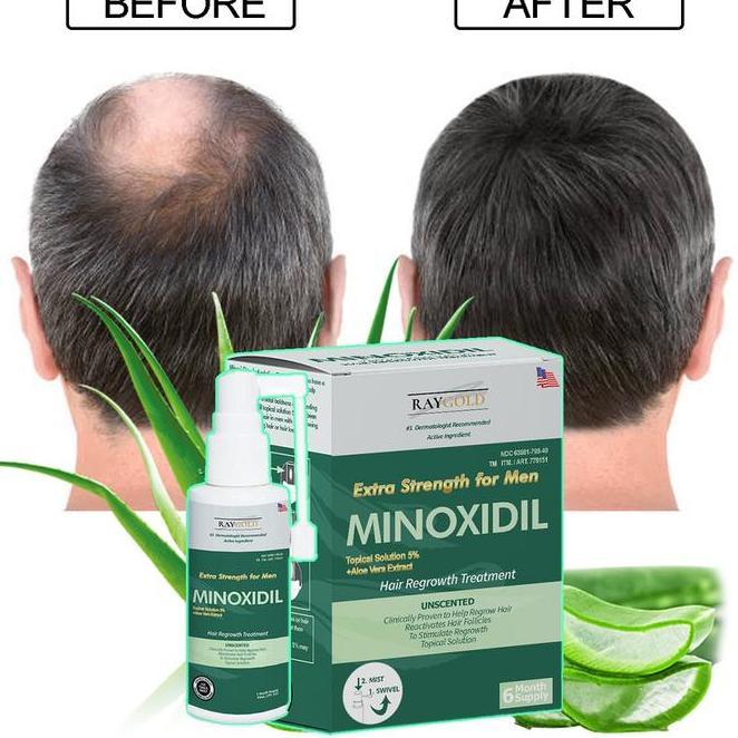 Minoxidil 5 Penumbuh Rambut Brewok With Aloe Vera For Men Made In Usa Raygold Minox Minoksidil Anti 