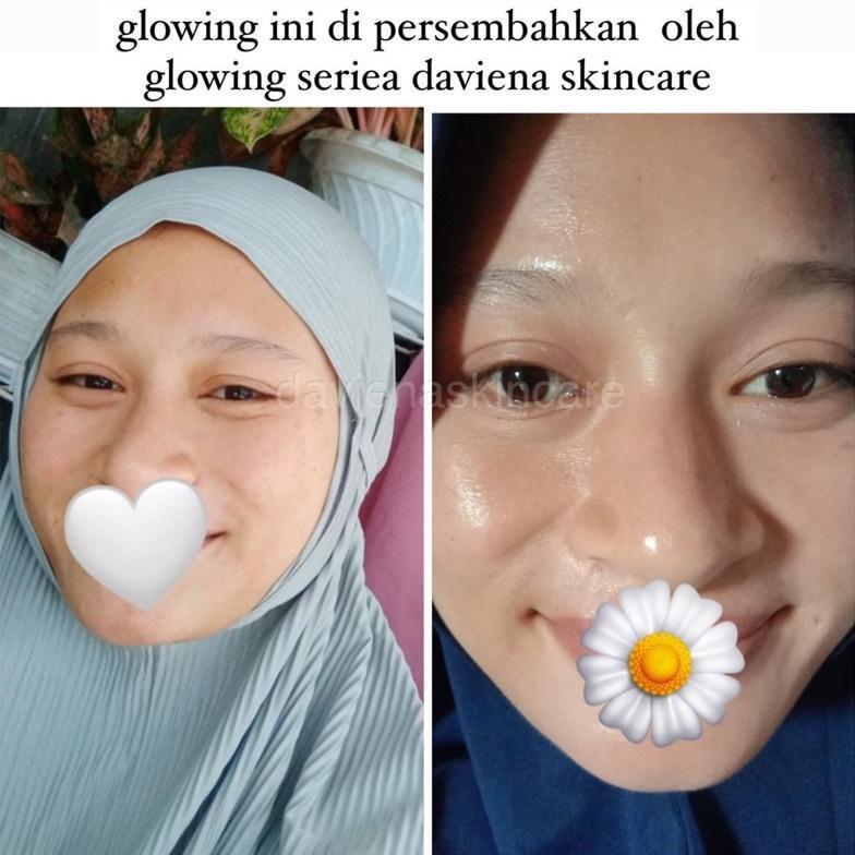 Cod [Official] Daviena Skincare | Glowing Series | Pemutih Wajah Bpom|Davina Skincare Hemat