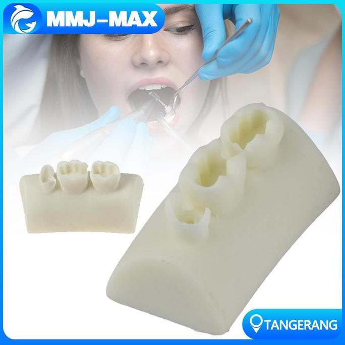 WODRUFT Model Latihan Tambal Gigi/Model Tambalan Gigi/Dental Practice Model
