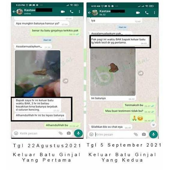 Cleaanea- Obat Herbal Kewanitaan Keputihan Miom Serviks Mazon B Dan K Muricata