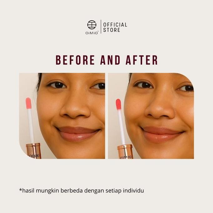 Bytcwr- Oimio Lip Serum [Melembabkan Dan Menutrisi Bibir] Untuk Bibir Kering Dan Hitam