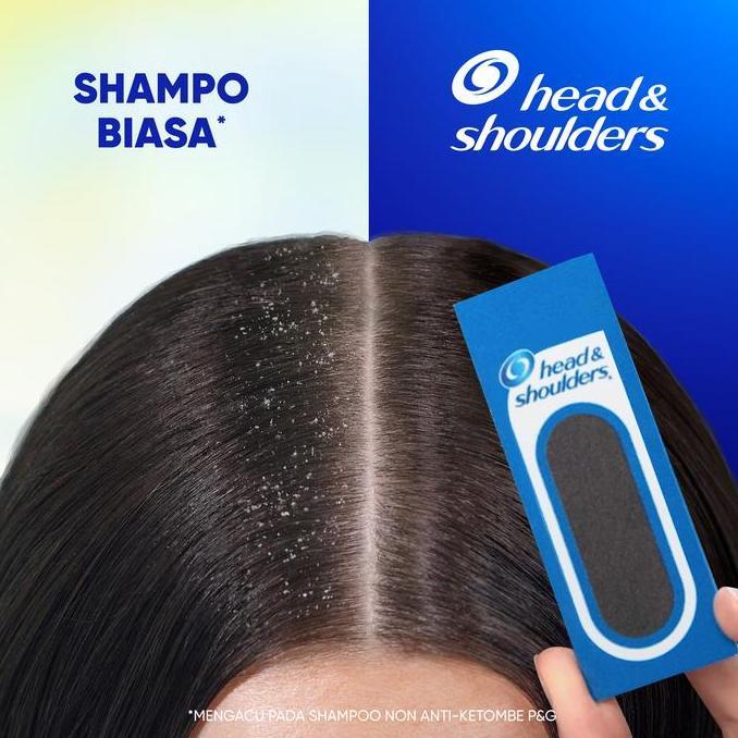 Styling- Head And Shoulder Shampoo Lemon Fresh 160Ml