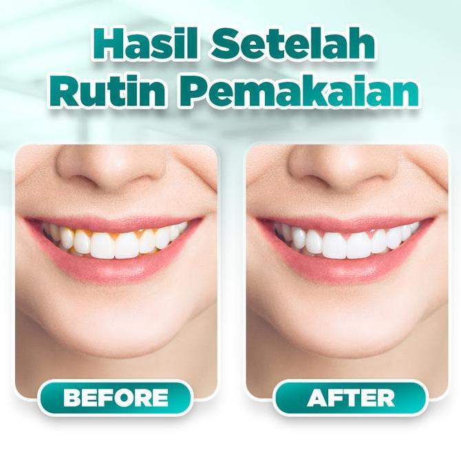 Lansungkirim- Pieras Propolinse Sikat Gigi Elektrik Dan 5 Botol Propolinse