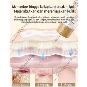 Hayuco- Salep Kaki Pecah Pecah Kering Krim Pelembap Untuk Kaki Kering Dan Pecah-Pecah 60 Gram Perawa