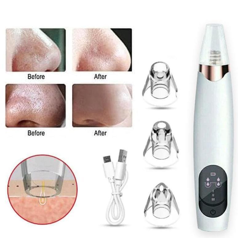 Remove Blackhead Alat Vacum Penyedot Komedo / Alat Sedot Komedo Penghilang Penyedot Komedo