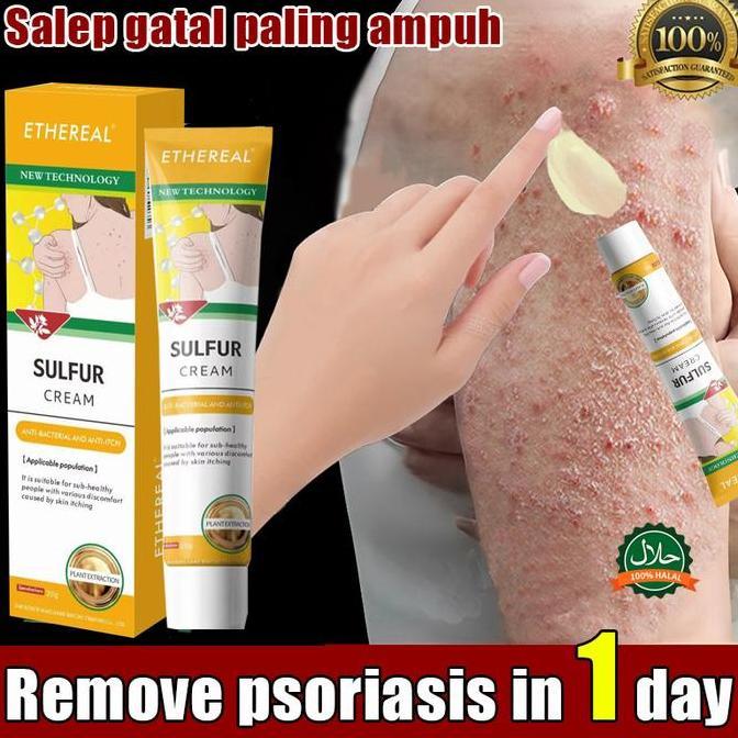 Salep Krim Belerang Anti Gatel Salep Kurap Panu Scabies Psoriasis Jamur Ampuh Allshop