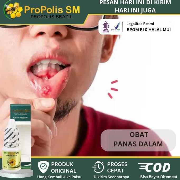 Propolis Sm - Menhilangkan Panas Dalam Anak Dewasa, Panas Dalam Dan Sariawan, Tenggorokan Panas Dala