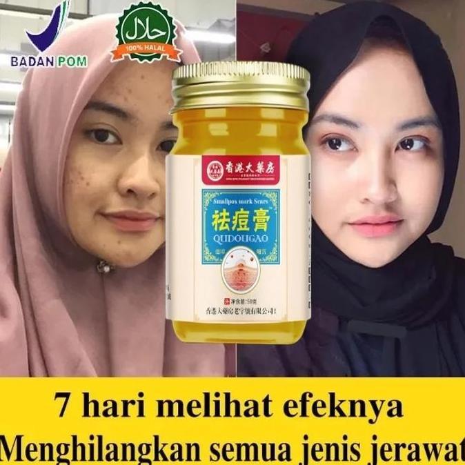 Ampuh Cream Penghilang Jerawat Permanen Bpom Penghilang Bekas Jerawat Bopeng Bekas Jerawat Pria Dan 